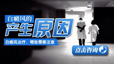 生活细节容易诱发白癜风